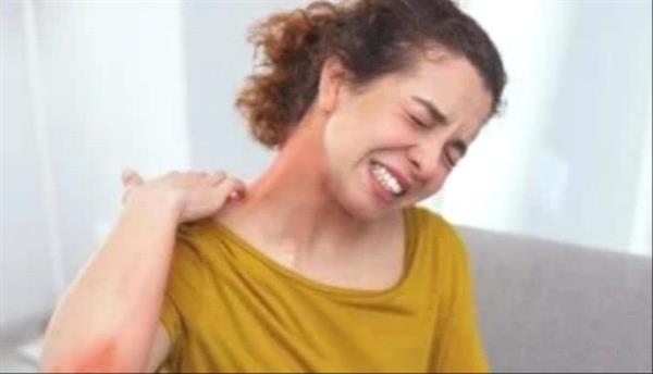 إكزيما الرقبة.. علامات الإصابة وهل الوراثة أحد الأسباب؟
