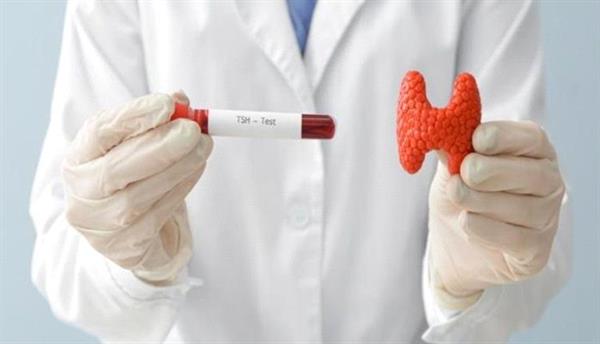 كيفية الاستعداد لإجراء تحليل الغدة الدرقية.. وما هي أنواعه؟