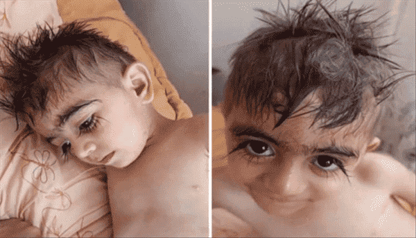  فيديو لـ صاحب "أطول رموش في العالم".. وأقاربه يكشفون السر وراء ذلك!
