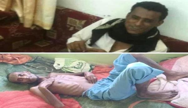 حزب الإصلاح يصفي شاب بعد 6 سنوات من اختطافه في تعز.. صورتين تكشف وحشية تعذيبه
