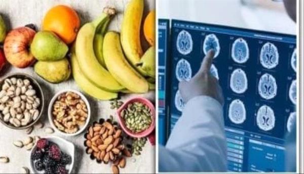 5 أطعمة لتعزيز الذاكرة والوقاية من مرض الزهايمر