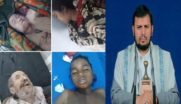 "الحوثي يُنكر مسؤولية جماعته عن مذبحة رداع ويتهم السعودية بتمويل حملات إعلامية لصالح إسرائيل"
