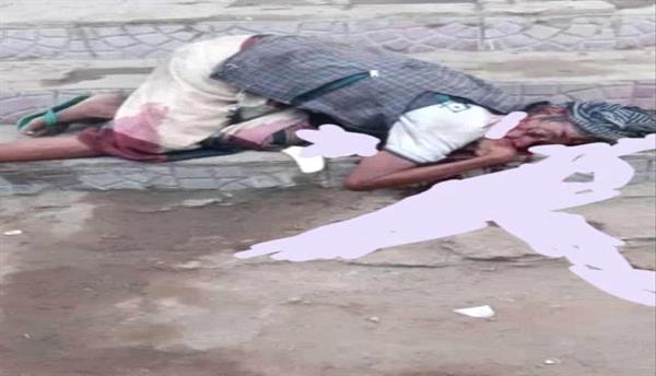 جريمة مروعة تهزّ حجة: مليشيات الحوثي تقتل رجلاً وتعتدي على زوجته في الشارع!.
