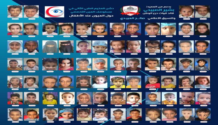 نجاح كبير لـ”المخيم الثاني لتصحيح الحول” .. اكثر من 80 طفل مستفيد
