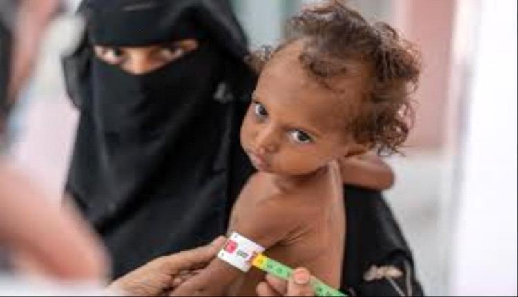 الأمم المتحدة: 60% من الأطفال اليمنيين يعانون من التقزم بسبب الحرب والفقر