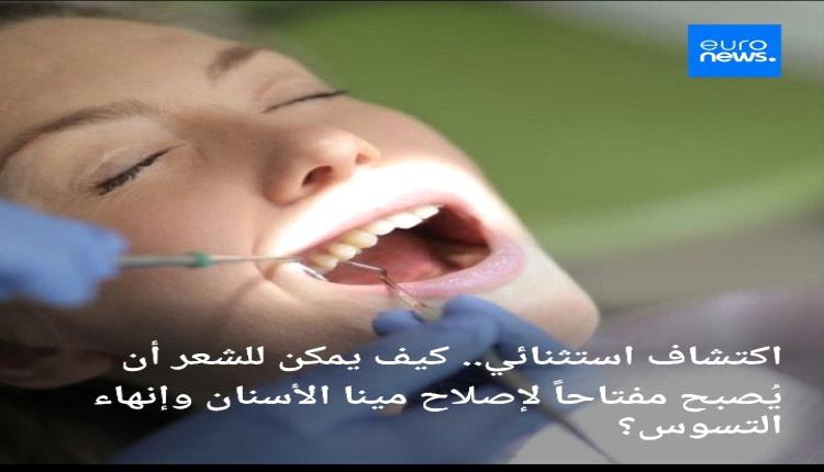 بقايا الشعر والصوف يمكن أن تصبححلا مبتكرا لإصلاح مينا الأسنان ووقف التسوس