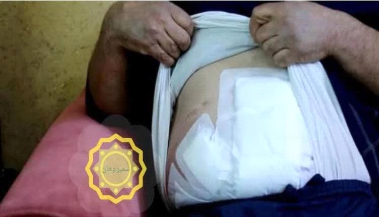 خلاف عائلي يتحوّل لجريمة دمويّة.. شقيق يطعن أخاه بسبب خروج ابنته بدون محرم