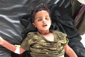الكوليرا تعود إلى الضالع.. وفاة طفل وغياب الدعم يهدد بانفجار وبائي جديد