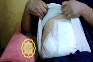 خلاف عائلي يتحوّل لجريمة دمويّة.. شقيق يطعن أخاه بسبب خروج ابنته بدون محرم