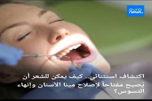 بقايا الشعر والصوف يمكن أن تصبححلا مبتكرا لإصلاح مينا الأسنان ووقف التسوس