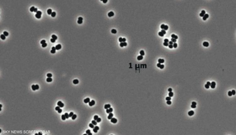 حتى في بيئة معقمة.. اكتشاف بكتيريا قادرة على التظاهر بالموت