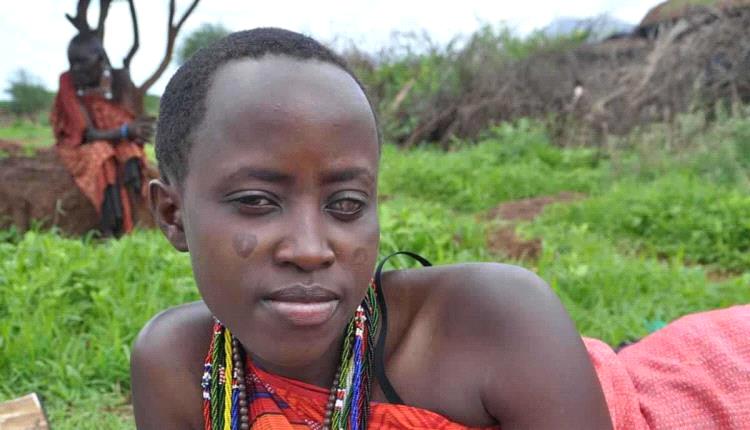 العمى النهري يواصل تهديد اليمن وأفريقيا رغم التقدم الطبي