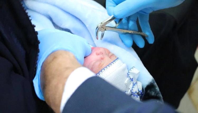 مولود عراقي يولد بسن لبني ويذهل الأطباء