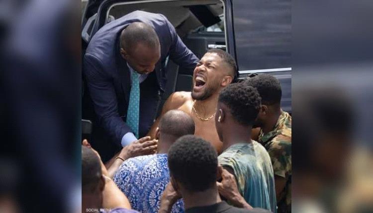 إصابة جوشوا بطل العالم السابق في الملاكمة بحادث مروع