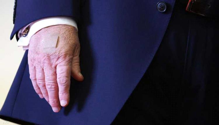 تساؤلات بشأن صحة ترامب.. "اليد اليسرى" تثير جدلا