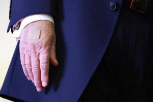 تساؤلات بشأن صحة ترامب.. "اليد اليسرى" تثير جدلا