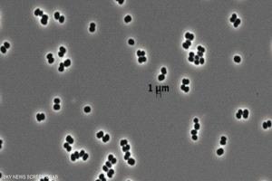 حتى في بيئة معقمة.. اكتشاف بكتيريا قادرة على التظاهر بالموت
