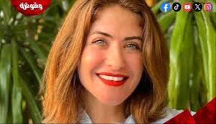هيدي كرم تعلن رأيها في عمليات التجميل