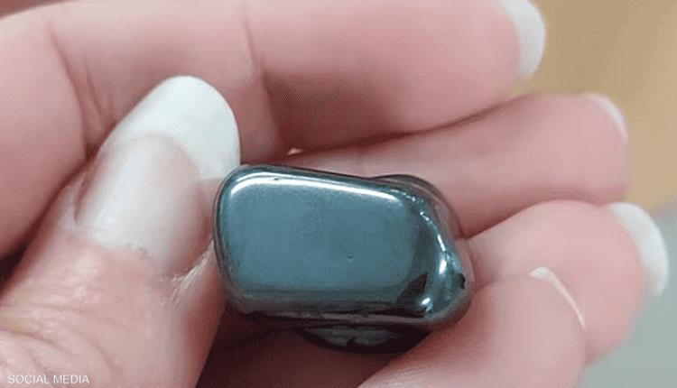طفل واجه الموت.. مغناطيسان يجذبان بعضهما داخل معدته