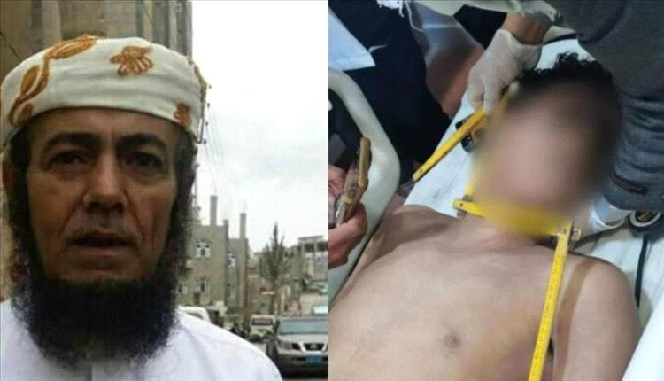 رُقية قاتلة: فتى يفقد حياته تحت أيدي شيخ يزعم طرد السحر