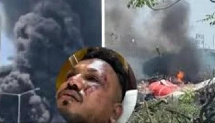 “خرجت من بين الأنقاض”.. الناجي الوحيد من كارثة طائرة الهند يروي لحظات الرعب والموت