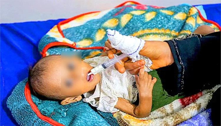 تقليص المساعدات يفتح أبواب الكارثة في اليمن: الملايين على حافة الجوع والنظام الصحي يترنّح