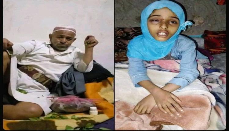 حين يتحوّل الشجار الطفولي إلى جريمة.. طفلة تُجلد بدم بارد أمام أمها والعدالة غائبة!