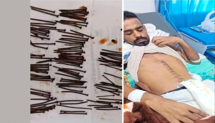 117 مسماراً في بطن رجل!.. حادثة غريبة تهز الأوساط الطبية في اليمن
