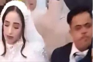 النيابة تسليم عروس قاصر لوالدتها بعد زواجها من مصاب بمتلازمة داون
