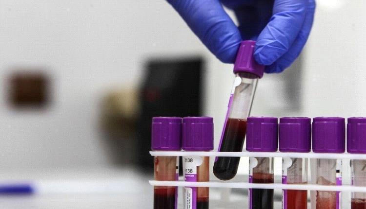 اقوى علاج طبيعي لمنع تكون السرطان في الجسم