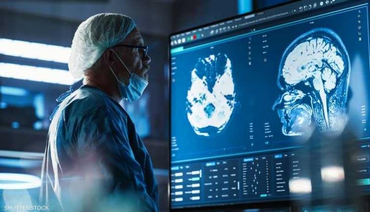 إنجاز علمي.. اكتشاف المنطقة المسؤولة عن الوعي في الدماغ