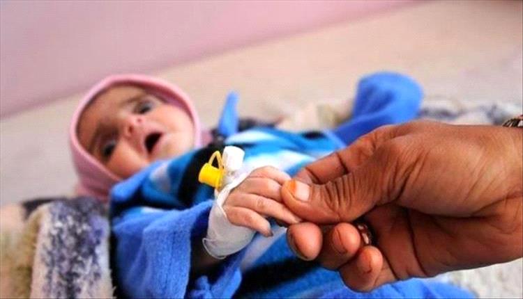 سوء التغذية طال نحو نصف أطفال اليمن جراء الأزمة الإنسانية
