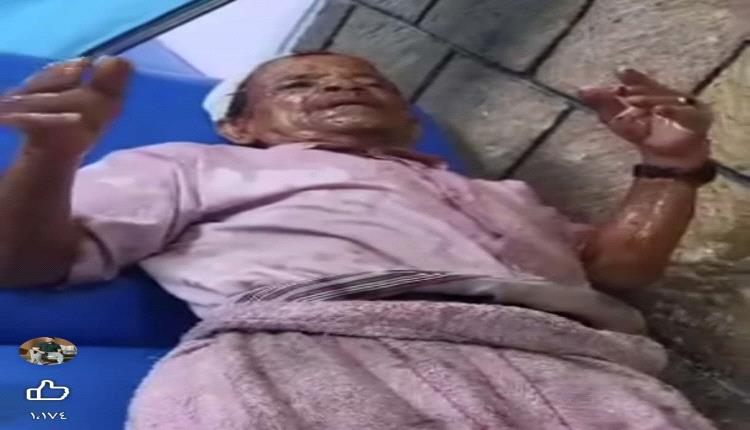 بائع الزلابية: الجندي صب الزيت الساخن عليّ بسبب هذه الكلمة... والنتيجة صادمة