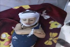 وفاة طفل إثر رجم بحجر في مشاجرة بين طفلين