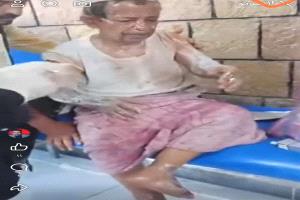 الزلابية تحترق والكرامة لا تسقط.. العم علي ضحية "ركلة" حوثية في إب
