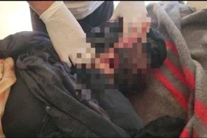 استشهاد امرأة برصاص قناص حوثي في يافع