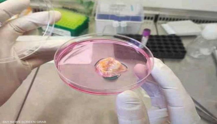 مركز أبوظبي للخلايا الجذعية يطلق علاجا مبتكرا للسرطان