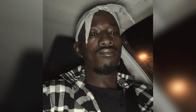 "دودو كروس بيتوم" في قلب فضيحة سرقة متحف اللوفر