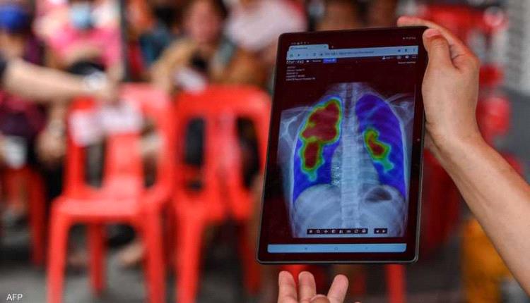 الصحة العالمية: وفاة أكثر من مليون شخص بهذا المرض