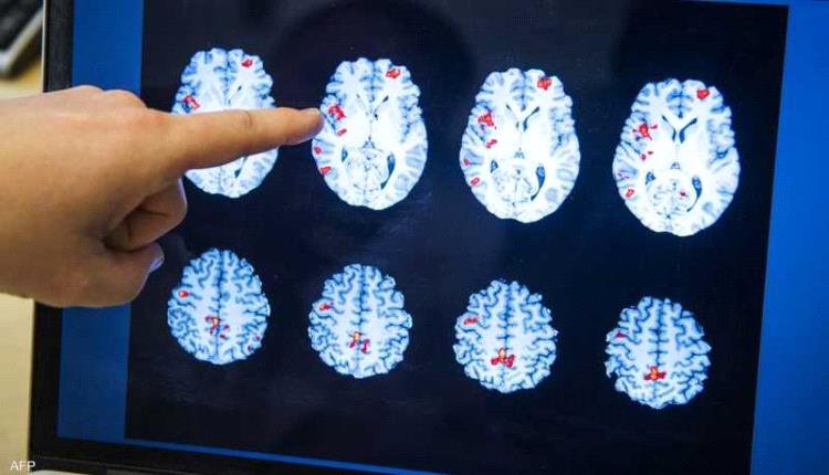 أزمة صامتة تضرب أميركا.. ارتفاع مقلق في الإعاقات الإدراكية