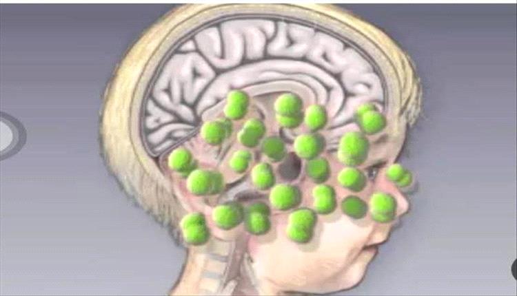 26 وفاة و1,232 إصابة بالحمّى الشوكية في ثلاث محافظات خلال 2025