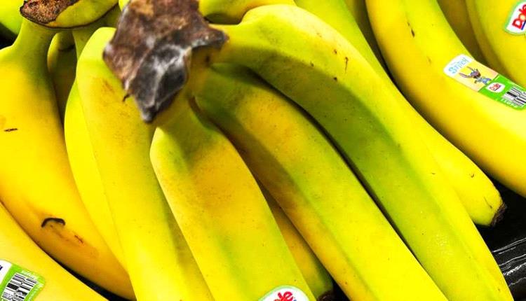 فرك الوجه بقشور الموز.. هل يعادل تأثير حقن البوتوكس؟