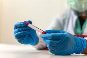 ابتكار روسي يضاعف فعالية علاج سرطان الدم ثماني مرات