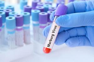 تفشي مميت لإيبولا "ماربورغ" جنوب إثيوبيا