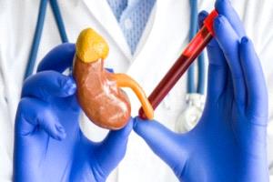 تحليل دم جديد يتفوق على الكرياتينين في توقع أمراض الكلى