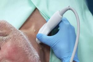 فحص رقبة بسيط يكشف خطر النوبات القلبية قبل سنوات من حدوثها