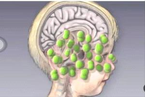 26 وفاة و1,232 إصابة بالحمّى الشوكية في ثلاث محافظات خلال 2025