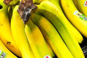 فرك الوجه بقشور الموز.. هل يعادل تأثير حقن البوتوكس؟