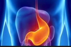 عاجل.. 5 علامات مبكرة لسرطان المعدة يصعب ملاحظته