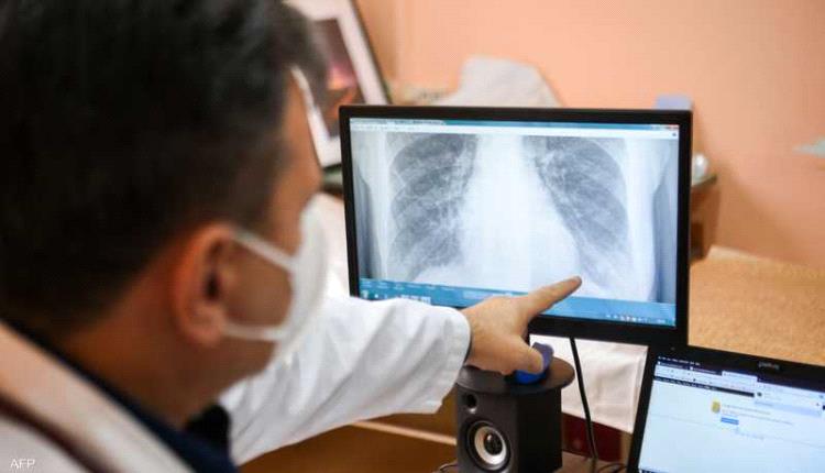 دراسة: "طريقة سهلة" لحماية رئتيك من آثار تلوث الهواء
